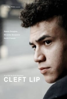 Cleft Lip online