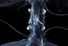 Escena de Águas-vivas mortais