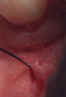 Películas de Zoe Karpeta