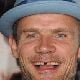 Flea