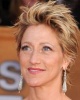 Edie Falco