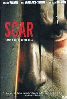 Scar 3D