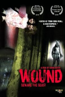 Wound online