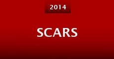 Scars